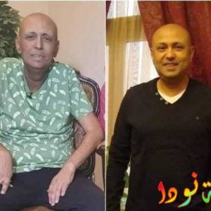 جمال يوسف قبل وبعد المرض